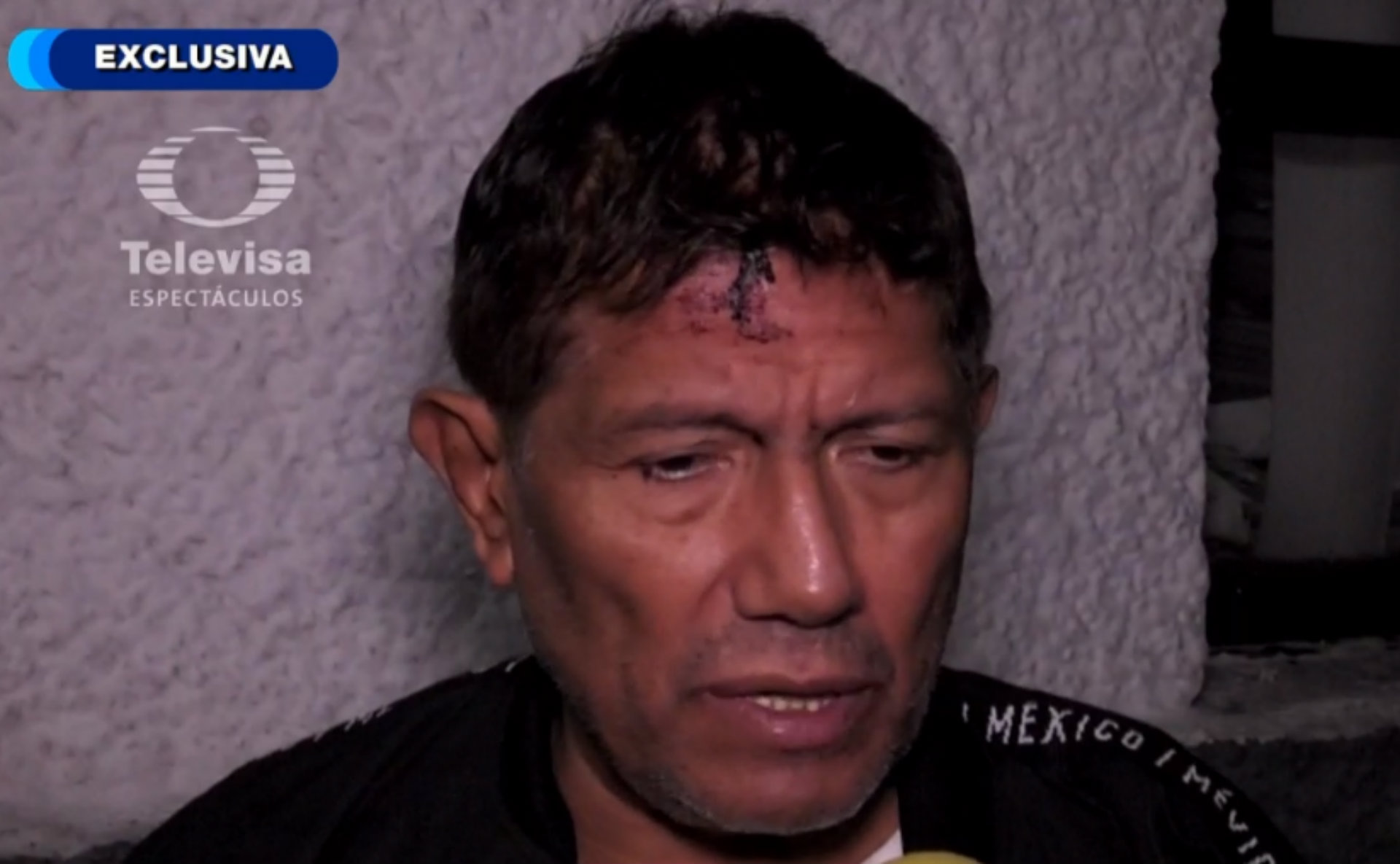 Así lució el productor después del asalto