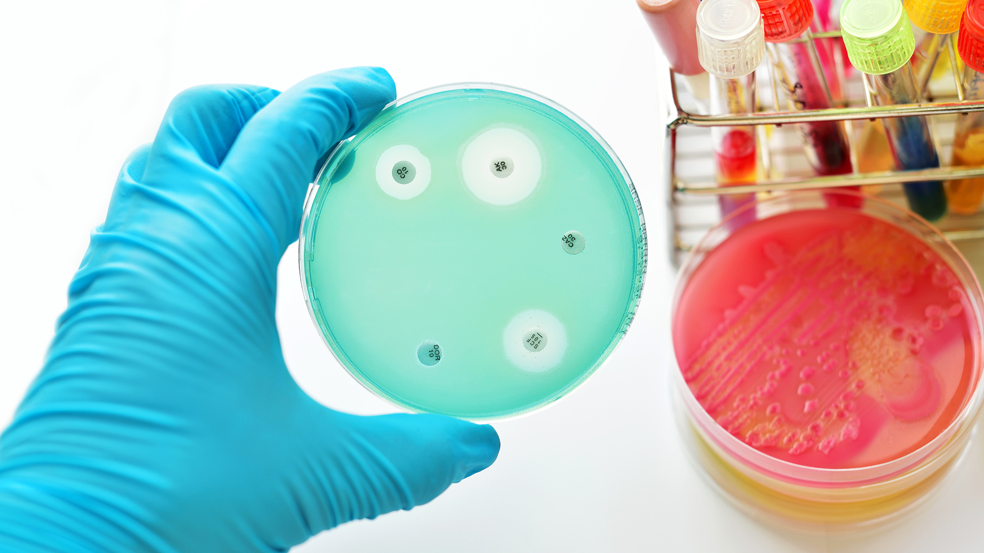 Las startups de antibióticos sufren problemas financieros y las grandes farmacológicas se van a otros campos como la oncología. (iStock)
