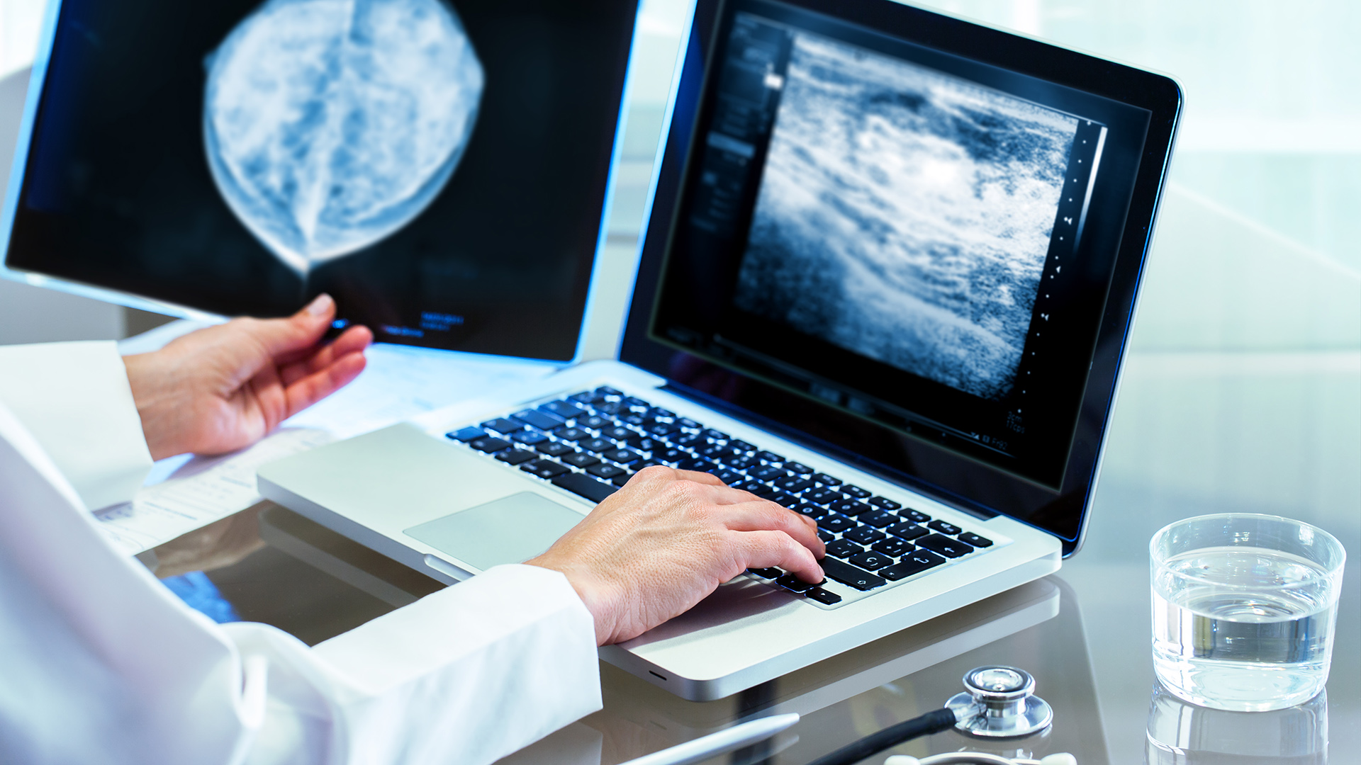 La evaluación de la densidad mamaria generalmente se realiza en función de la cantidad de tejido fibroglandular en relación con el tejido graso presente en la mamografía (Shutterstock)