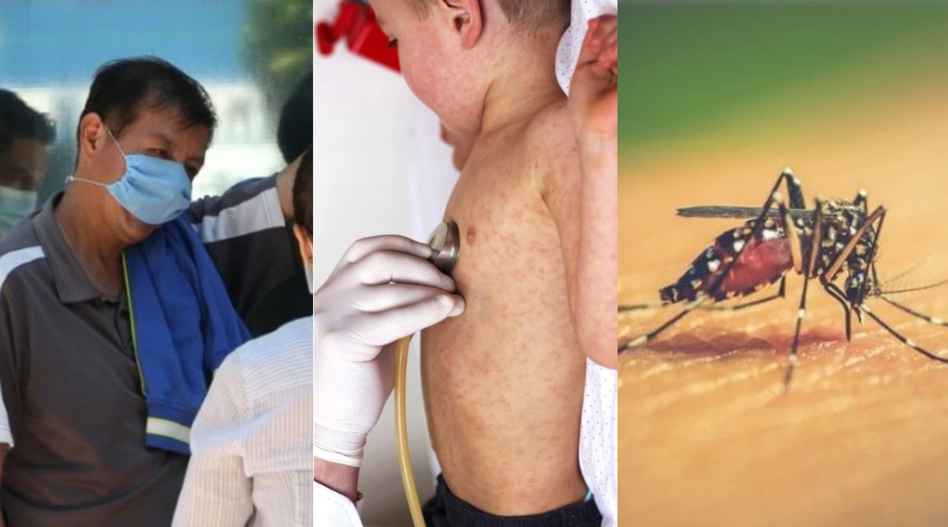 El COVID-19, el sarampión y el dengue son tres enfermedades que actualmente coexisten en Argentina