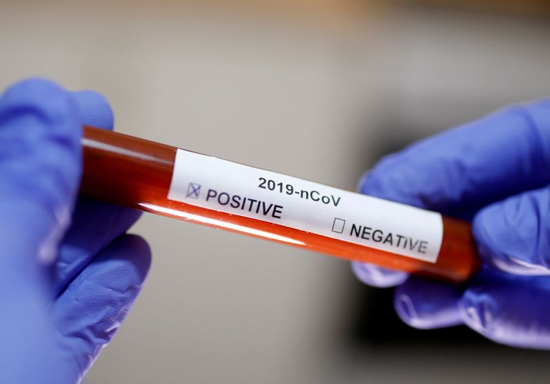 El país sudamericano se había mantenido hasta el momento al borde de la pandemia (REUTERS/Dado Ruvic)