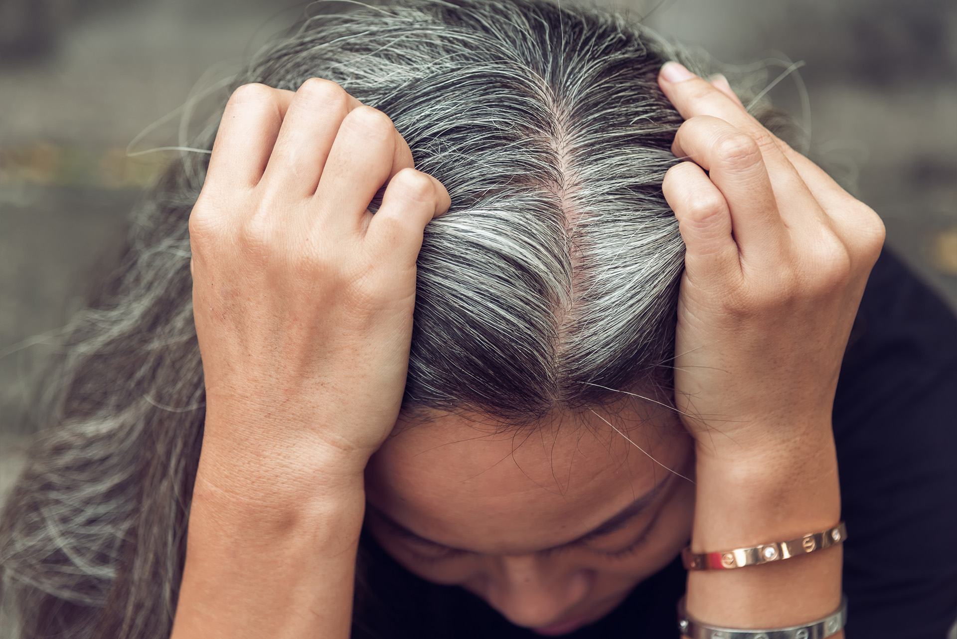 Descubren cómo es que el estrés genera canas Confirmado: el estrés provoca la aparición de canas - Infobae
