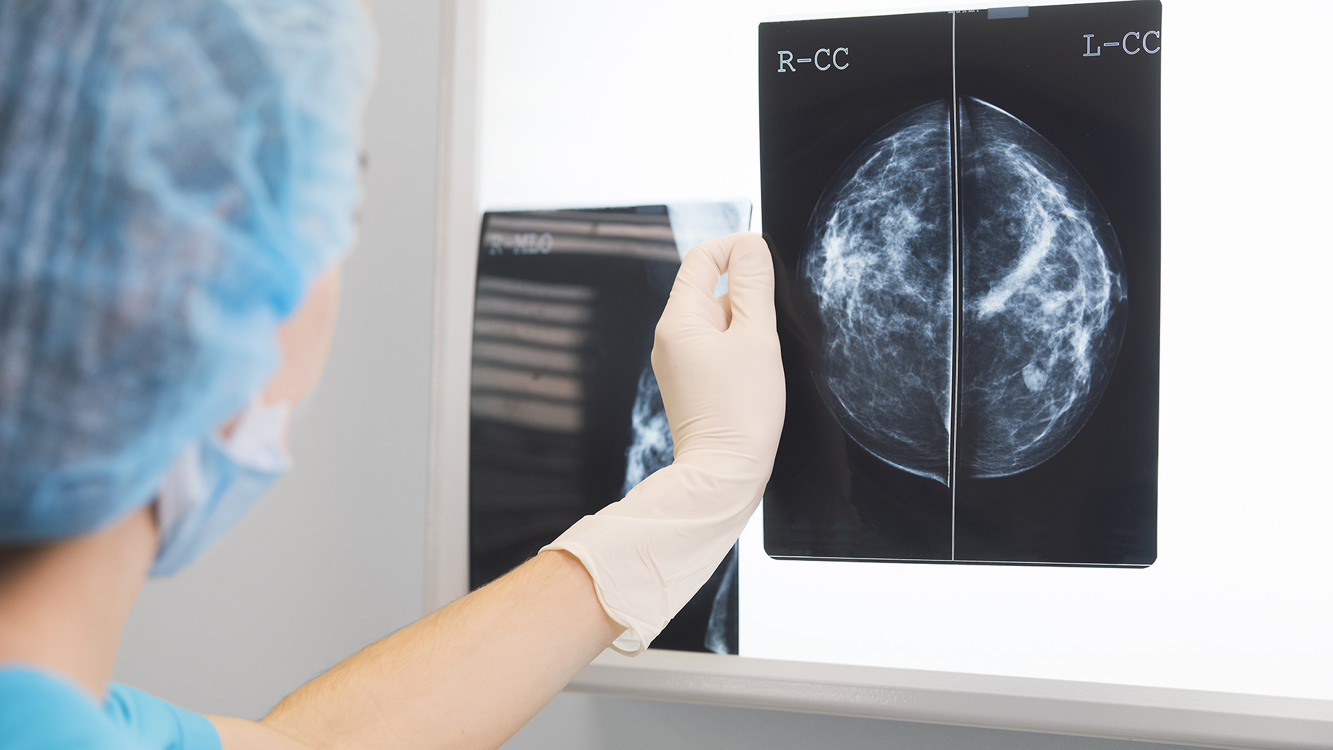 Las recomendaciones para las pacientes con cáncer de mama y los cuidados durante la pandemia (Shutterstock)