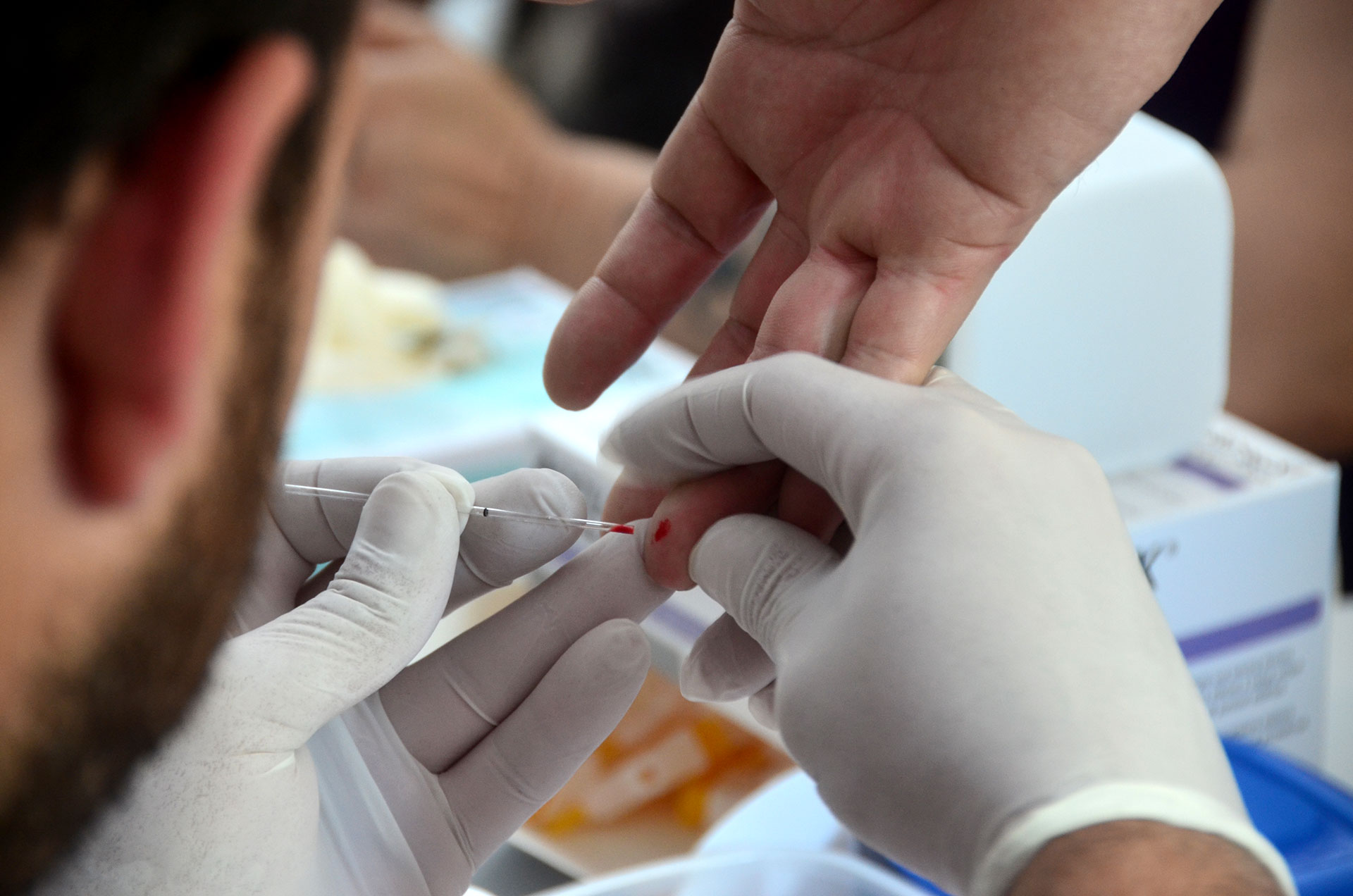 El VIH no tiene síntomas. Por lo tanto, la única manera de saber si alguien contrajo el VIH es a través de un test que consiste en un análisis de sangre