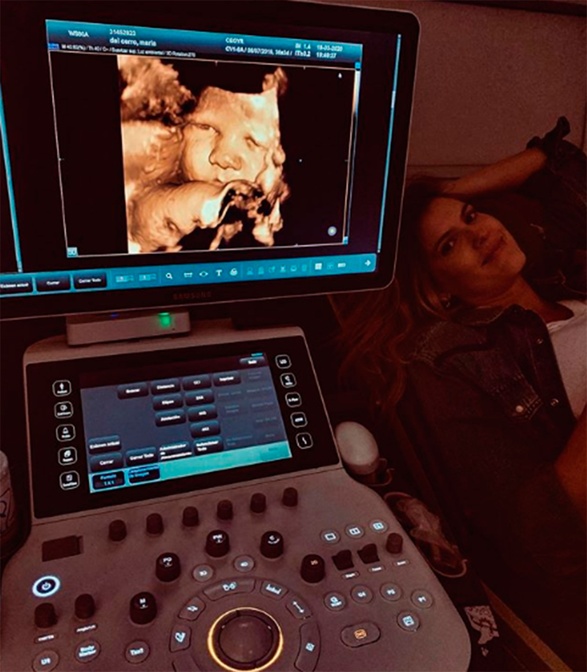 La ecografia de la hija de Mery del Cerro (Instagram)