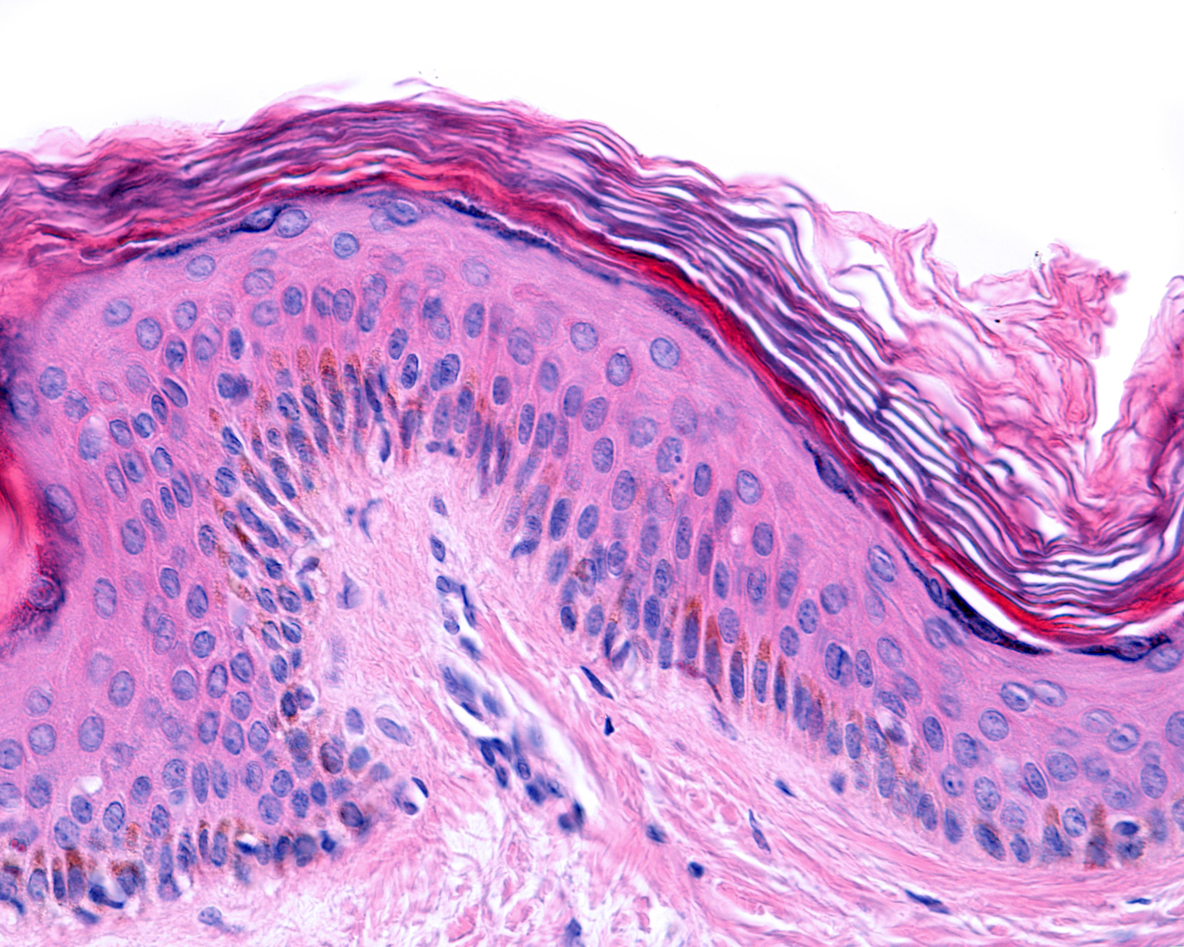 Dermatólogos españoles están detectando, y tienen interés de cuantificar y clasificar en este estudio, la aparición de alteraciones dermatológicas en cualquier zona de la piel, coincidentes con la infección por SARS-CoV-2 (Shutterstock)